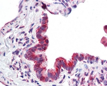 IHC testing of FFPE human lung tissue with CBARA1 antibody at 3.75ug/ml. Required HIER: steamed antigen retrieval with pH6 citrate buffer; AP-staining.