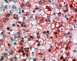 AXIN1 Antibody Adrenal Cortex IHC. Immunohistochemistry testing of FFPE human adrenal cortex with AXIN1 antibody at 4ug/ml. HIER: steamed with pH6 citrate buffer, AP-staining.