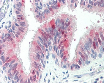 IHC testing of FFPE human lung tissue with ZDHHC13 antibody at 5ug/ml. Required HIER: steamed antigen retrieval with pH6 citrate buffer; AP-staining.