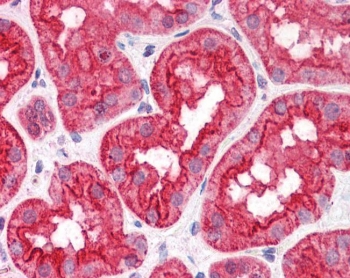 IHC testing of FFPE human kidney tissue with ABHD5 antibody at 3.75ug/ml. Required HIER: steamed antigen retrieval with pH6 citrate buffer; AP-staining.