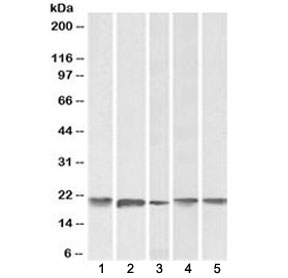 FTL Antibody Brain Liver WB. Western blot testing of human 1) cerebellum, 2) liver, 3) placenta, 4) mouse brain and 5) rat brain lysate with FTL antibody at 0.1ug/ml. Predicted molecular weight: ~20 kDa.