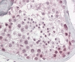 IHC staining of FFPE human testis with Pescadillo antibody at 4ug/ml. HIER: steamed with pH6 citrate buffer, AP-staining.
