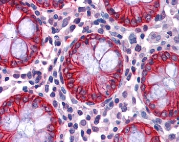 IHC testing of FFPE human colon tissue with NDRG1 antibody at 2.5ug/ml. Required HIER: steamed antigen retrieval with pH6 citrate buffer; AP-staining.