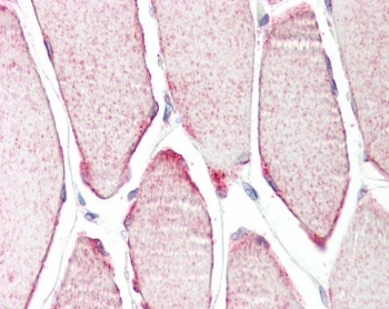 IHC testing of FFPE human skeletal muscle tissue with MURF3 antibody at 3.75ug/ml. Required HIER: steamed antigen retrieval with pH6 citrate buffer; AP-staining.