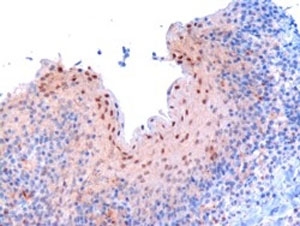 IHC testing of FFPE human tonsil with RANBP9 antibody at 3ug/ml.  Microwaved antigen retrieval with Tris/EDTA buffer pH9,  HRP-staining.