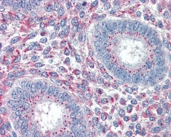 IHC testing of FFPE human uterus tissue with PRRX1 antibody at 5ug/ml. Required HIER: steamed antigen retrieval with pH6 citrate buffer; AP-staining.