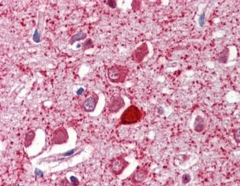 IHC testing of FFPE human brain cortex with Parvalbumin antibody at 2.5ug/ml. Required HIER: steamed antigen retrieval with pH6 citrate buffer; AP-staining.