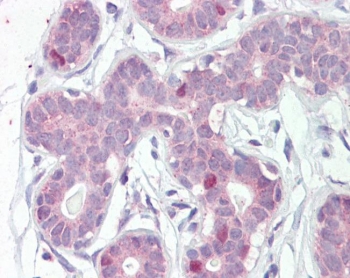 FOXA1 Antibody Breast IHC. Immunohistochemistry staining of FFPE human breast tissue with FOXA1 antibody at 5ug/ml. HIER: steamed with pH6 citrate buffer, AP-staining.