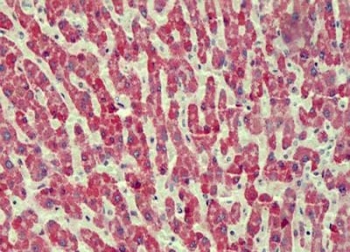 IHC testing of FFPE human liver tissue with ANTXR2 antibody at 2.5ug/ml. Required HIER: steamed antigen retrieval with pH6 citrate buffer; AP-staining.