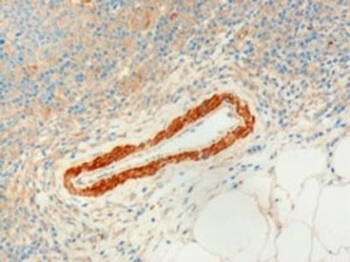 IHC testing of FFPE human lymph node with USP20 antibody at 3ug/ml. Microwaved antigen retrieval with Tris/EDTA buffer pH9, HRP-staining.