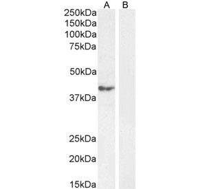 Western blot testing of human cerebellum tissue lysate in the absence (A) and presence (B) of immunizing peptide, with RCAN1 antibody.