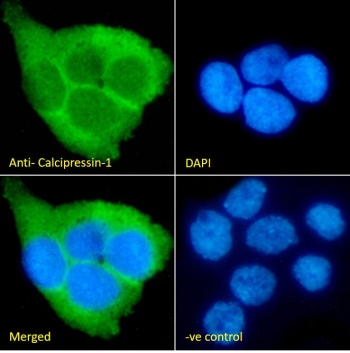 IF/ICC staining of fixed and permeabilized human A431 cells with RCAN1 antibody (green) at 10ug/ml and DAPI nuclear stain (blue).