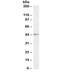 TDP-43 Antibody Jurkat WB. Western blot testing of Jurkat lysate with TDP-43 antibody at 0.3ug/ml. Predicted molecular weight ~43 kDa.
