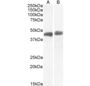TDP-43 Antibody Cerebellum and Hippocampus WB. Western blot testing of A) human cerebellum and B) human hippocampus tissue lysates with TDP-43 antibody at 1ug/ml. Predicted molecular weight ~43 kDa.