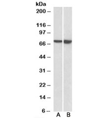 LCP1 Antibody / L-Plastin Antibody Daudi and U937 WB. Western blot analysis of LCP1 expression was performed using anti-LCP1 antibody in Daudi and U937 cell lysates. LCP1, also known as L-Plastin or Lymphocyte Cytosolic Protein 1, is a calcium-regulated actin-bundling protein predominantly expressed in hematopoietic cells and involved in leukocyte activation, migration, and cytoskeletal remodeling. Lane A: Daudi lysate. Lane B: U937 lysate. A prominent immunoreactive band is detected at approximately 70 kDa in both cell lines, corresponding to the predicted molecular weight of LCP1. Strong expression in B lymphocyte-derived Daudi cells and monocytic U937 cells is consistent with the established role of L-plastin as a marker of hematopoietic lineages and mediator of immune cell function. These results support the utility of LCP1 Antibody / L-Plastin Antibody for studies of inflammation, hematopoiesis, immune cell biology, and cell migration.