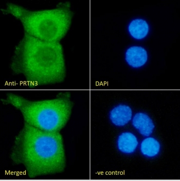 Immunofluorescent staining of fixed and permeabilized human A431 cells with Proteinase 3 antibody (green) at 10ug/ml and DAPI nuclear stain (blue).
