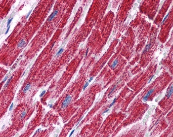 IHC testing of FFPE human heart tissue with FH antibody at 3.75ug/ml. Required HIER: steamed antigen retrieval with pH6 citrate buffer; AP-staining.