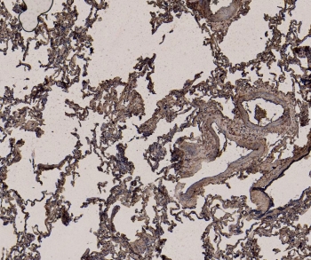 IHC testing of FFPE human lung tissue with GAPDH loading control antibody at 6ug/ml. Required HIER: steamed antigen retrieval with pH6 citrate buffer; HRP-staining.