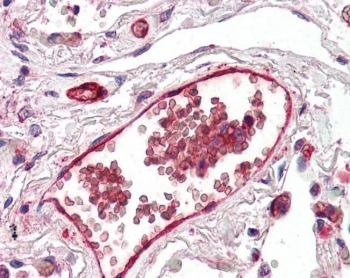 IHC staining of FFPE human kidney with DARC antibody at 5ug/ml. Required HIER: steamed antigen retrieval with pH6 citrate buffer; AP-staining.