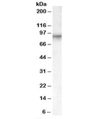 Western blot testing of human placenta lysate with Factor XIIIa antibody goat polyclonal at 0.1ug/ml. Predicted molecular weight: ~83 kDa.