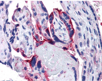 IHC testing of FFPE human placenta tissue with APH1A antibody at 5ug/ml. Required HIER: steamed antigen retrieval with pH6 citrate buffer; AP-staining.