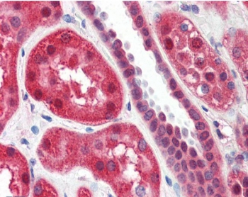 IHC testing of FFPE human kidney tissue with ALOX15 antibody at 2ug/ml. Required HIER: steamed antigen retrieval with pH6 citrate buffer; AP-staining.