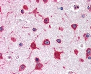 RPL8 Antibody Cerebral Cortex IHC. Immunohistochemistry staining of FFPE human cerebral cortex with RPL8 antibody at 2.5ug/ml. HIER: steamed with pH6 citrate buffer, AP-staining.