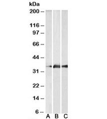 KLK5 Antibody Brain WB. Western blot analysis of A) human cerebellum, B) mouse brain, and C) rat brain lysates using KLK5 Antibody detects bands at approximately 32 kDa, consistent with the predicted molecular weight of Kallikrein 5 / KLK5. This Stratum corneum tryptic enzyme antibody highlights conserved expression of epithelial-associated serine protease signaling machinery across multiple mammalian tissues and supports characterization of kallikrein family-associated proteolytic regulation pathways.