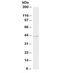DAPK2 Antibody Mouse Brain WB. Western blot analysis of mouse brain tissue lysate using DAPK2 antibody demonstrates detection of an immunoreactive band at approximately 43 kDa, consistent with the predicted molecular weight of Death Associated Protein Kinase 2 (DAPK2). DAPK2 is a calcium/calmodulin-regulated serine/threonine kinase that participates in intracellular signaling pathways involved in apoptosis, cellular stress responses, autophagy regulation, and maintenance of cellular homeostasis. The observed band supports expression of DAPK2 in neural tissue and demonstrates the utility of this antibody for studies of kinase-mediated signaling, programmed cell death pathways, and stress-responsive regulatory mechanisms. Western blot was performed using 2 ug/ml primary antibody. Predicted/observed molecular weight: ~43 kDa.