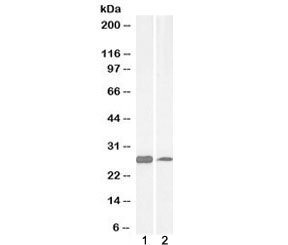 Western blot testing of human 1) cerebellum and 2) liver lysate and PGAM1 antibody at 0.03ug/ml. Predicted molecular weight: ~28kDa.
