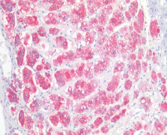 NCAM Antibody Goat Polyclonal. Immunohistochemistry analysis of FFPE human adrenal gland tissue demonstrates strong staining in neuroendocrine-associated cells consistent with expression of Neural cell adhesion molecule 1 (NCAM1), also known as CD56. Red chromogenic signal highlights NCAM1-positive cells within adrenal tissue, reflecting the expected distribution of this cell surface adhesion molecule in neuroendocrine cell populations. Steamed antigen retrieval was performed using pH6 citrate buffer prior to antibody incubation, and staining was visualized using an alkaline phosphatase (AP) detection system.
