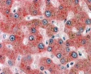 IHC staining of FFPE human liver with alpha-2-Antiplasmin antibody at 4ug/ml. HIER: steamed with pH6 citrate buffer, AP-staining.