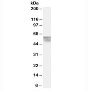 THRA Antibody / Thyroid Hormone Receptor Antibody Human Bone Marrow WB. Western blot analysis of human bone marrow lysate using THRA Antibody / Thyroid Hormone Receptor Antibody. A distinct immunoreactive band is detected at approximately 55 kDa, consistent with the predicted molecular weight of THRA, supporting specific detection of the endogenous thyroid hormone receptor alpha protein in human bone marrow tissue.