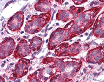 THRA Antibody / Thyroid Hormone Receptor Antibody Human Breast IHC. Immunohistochemical staining of FFPE human breast tissue using THRA Antibody / Thyroid Hormone Receptor Antibody at 3.75 ug/ml. THRA expression is observed predominantly within the nuclei of mammary epithelial cells, consistent with its function as a ligand-activated nuclear receptor that regulates thyroid hormone-responsive gene transcription. Heat-induced epitope retrieval was performed by steaming sections in pH 6 citrate buffer prior to AP-based immunostaining.