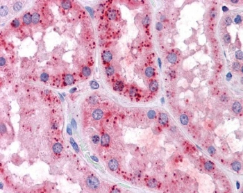 XCT Antibody Kidney Immunohistochemistry. IHC testing of FFPE human kidney tissue with XCT antibody at 3.75ug/ml. HIER: steamed antigen retrieval with pH6 citrate buffer; AP-staining.