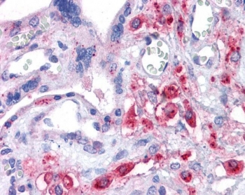 XCT Antibody Placenta Immunohistochemistry. IHC testing of FFPE human placental tissue with XCT antibody at 3.75ug/ml. HIER: steamed antigen retrieval with pH6 citrate buffer; AP-staining.