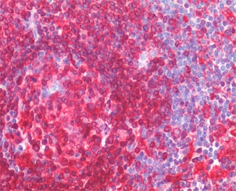 IHC staining of FFPE human spleen tissue with CD74 antibody at 5ug/ml. Required HIER: steamed antigen retrieval with pH6 citrate buffer; AP-staining.