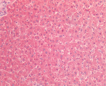 IHC testing of FFPE human liver tissue with TNFR2 antibody at 5ug/ml. HIER: steam section in pH6 citrate buffer for 20 min and allow to cool prior to staining.