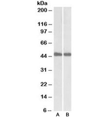 Western blot of mouse (A) and rat (B) liver lysates with IDH1 antibody at 0.1ug/ml. Predicted molecular weight ~46 kDa.