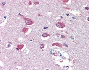 GRIA4 Antibody Human Cortex IHC. Immunohistochemistry was performed on FFPE human cerebral cortex tissue using GRIA4 Antibody at 5 ug/ml. Heat-induced epitope retrieval was carried out in pH 6 citrate buffer, and antibody binding was visualized using an alkaline phosphatase detection system. Distinct cytoplasmic staining is observed in cortical neurons, while the surrounding neuropil exhibits weaker immunoreactivity, consistent with the neuronal expression pattern of GRIA4 as an AMPA receptor subunit. These results demonstrate that this Glutamate Receptor 4 Antibody is suitable for immunohistochemical detection of GRIA4 in formalin-fixed, paraffin-embedded human brain tissue.