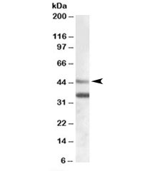Western blot testing of human heart lysate with ARSB antibody at 0.03ug/ml. The expected ~45kDa band and the additional ~35kDa band are both blocked by the immunizing peptide.
