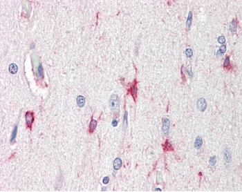 IHC testing of FFPE human brain (cortex) tissue with BAG3 antibody at 5ug/ml. Required HIER: steamed antigen retrieval with pH6 citrate buffer; AP-staining.