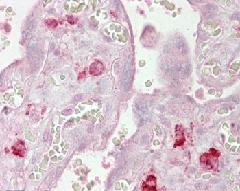 IHC testing of FFPE human placental tissue with AGO1 antibody at 2.5ug/ml. Required HIER: steamed antigen retrieval with pH6 citrate buffer; AP-staining.