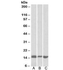Galectin 1 Antibody Mouse and Rat Pancreas WB. Western blot analysis of [A] mouse pancreas lysate, [B] rat pancreas lysate, and [C] NIH3T3 cell lysate using Galectin 1 antibody at 0.1 ug/ml. A distinct immunoreactive band is detected at approximately 15 kDa in all three samples, consistent with the predicted and observed molecular weight of Galectin-1 (LGALS1). Galectin-1 is a beta-galactoside-binding lectin involved in immune regulation, cell adhesion, apoptosis, extracellular matrix remodeling, and glycan-mediated signaling pathways. The consistent detection of endogenous Galectin-1 across mouse, rat, and cultured murine cell samples demonstrates the cross-species utility of this antibody for western blot applications. Predicted/observed molecular weight: ~15 kDa.