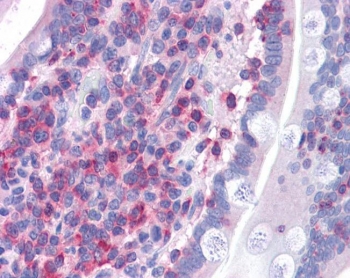 IHC testing of FFPE human small intestine tissue with FBP17 antibody at 3.75ug/ml. Required HIER: steamed antigen retrieval with pH6 citrate buffer; AP-staining.