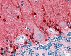 IHC staining of FFPE human cerebellum with Amphiphysin antibody at 2.5ug/ml. HIER: steamed with pH6 citrate buffer, AP-staining.