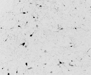 IHC testing of frozen human hypothalamus with Calbindin 1 antibody at 0.1ug/ml. A biotin secondary followed by SAv-HRP and DAB were used for the staining. Image courtesy of Prof. Erik Hrabovszky, Institute of Experimental Medicine, Budapest, Hungary.