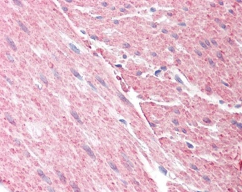 IHC testing of FFPE human colon tissue with GRAF antibody at 3.75ug/ml. Required HIER: steamed antigen retrieval with pH6 citrate buffer; AP-staining.