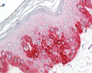 IHC testing of FFPE human skin tissue with ATG16L1 antibody at 3.75ug/ml. Required HIER: steamed antigen retrieval with pH6 citrate buffer; AP-staining.