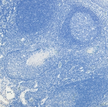 Negative control: IHC staining of FFPE human tonsil tissue without PRDM1 antibody. HIER: steamed with pH6 citrate buffer.